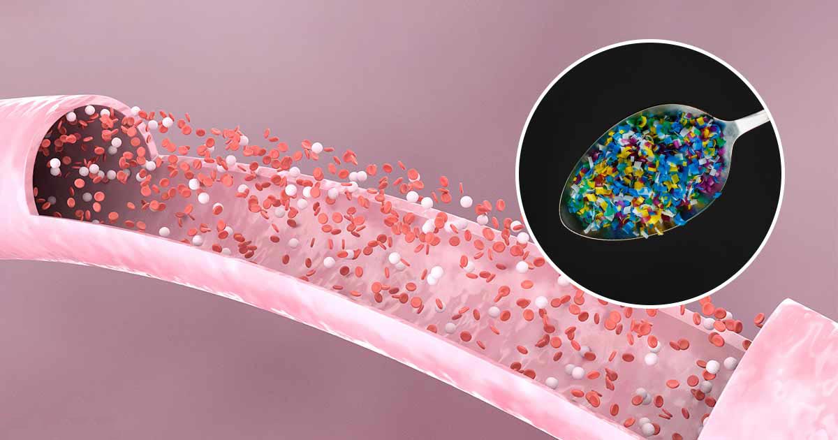 Scoperte per la prima volta microplastiche nel sangue umano