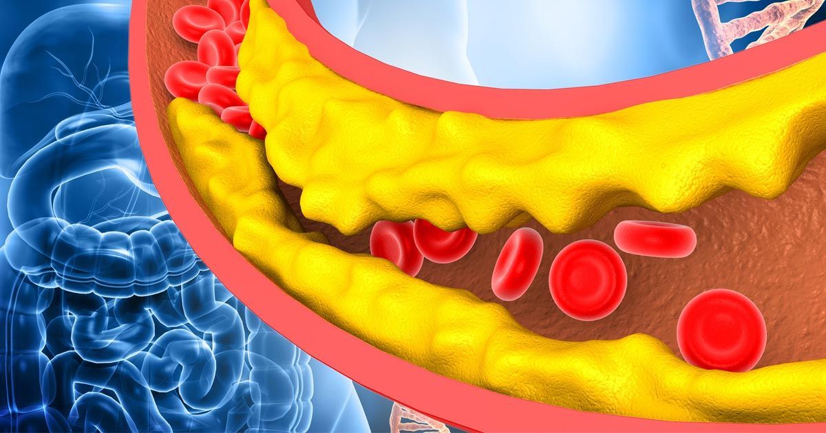 Le statine aumentano il rischio di diabete del 38%