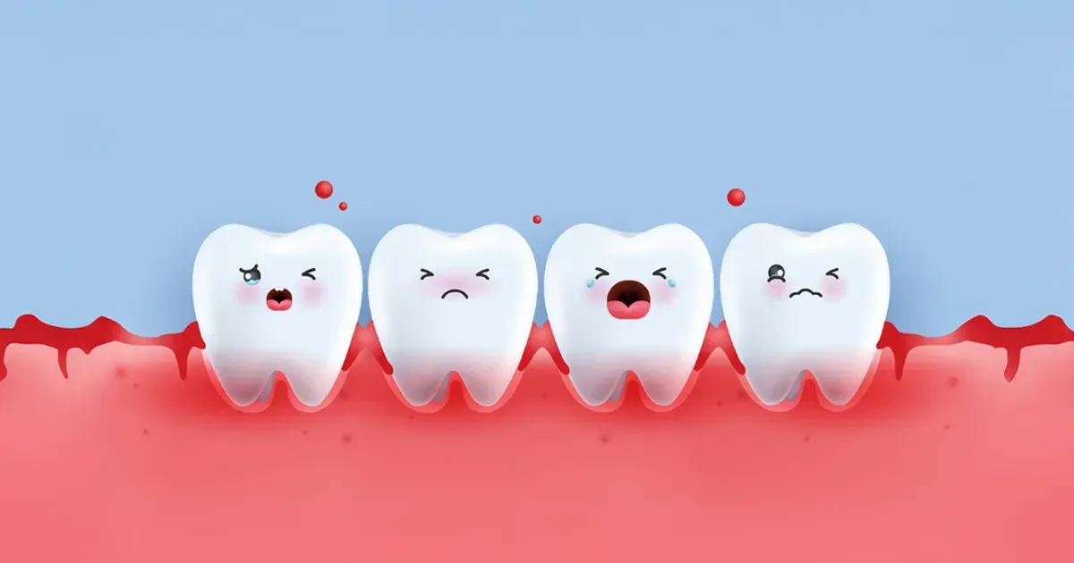 I sintomi della malattia gengivale sono collegati a un rischio più elevato di malattie croniche multiple