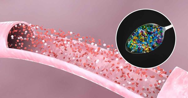 Scoperte per la prima volta microplastiche nel sangue umano