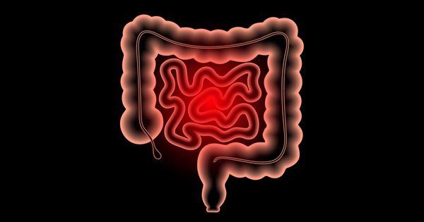 Antibiotici correlati a malattia infiammatoria intestinale